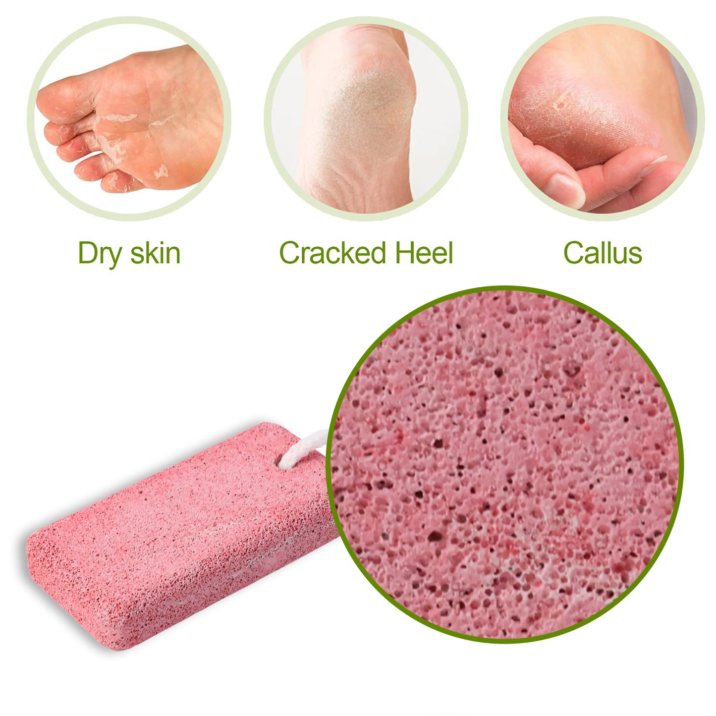 Rectangular Foot Pumice Stone For Dead Skin  Callus Removal (1 Pc)